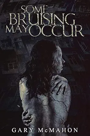 Some Bruising May Occur