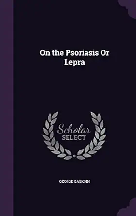 on the psoriasis or lepra 1st edition george gaskoin 1356860397, 978-1356860395
