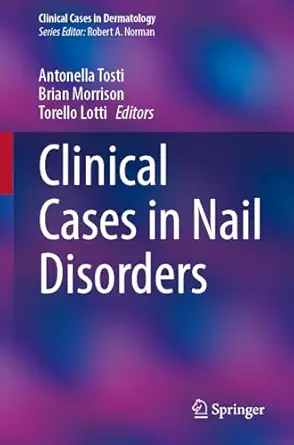 clinical cases in nail disorders 1st edition antonella tosti ,brian w morrison ,torello lotti 3031886410,