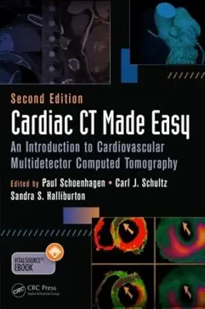 cardiac ct made easy an introduction to cardiovascular multidetector computed tomography 1st edition sandra s