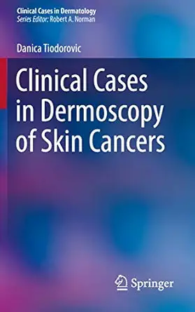 clinical cases in dermoscopy of skin cancers 1st edition danica tiodorovic 3030294463, 978-3030294465