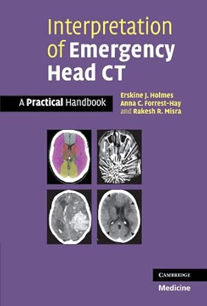 interpretation of emergency head ct a practical handbook 1st edition erskine j holmes ,anna c forrest hay