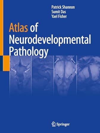 atlas of neurodevelopmental pathology 1st edition patrick shannon ,sumit das ,yael fisher 3032141478,
