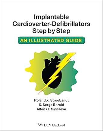 implantable cardioverter defibrillators step by step an illustrated guide 1st edition roland x stroobandt ,s