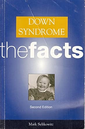 down syndrome the facts 1st edition mark selikowitz 0192626620, 978-0192626622