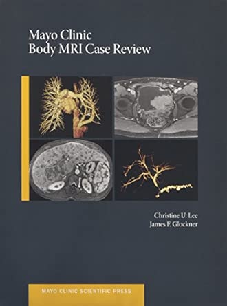 mayo clinic body mri case review 1st edition christine u c lee ,james glockner 0199915709, 978-0199915705