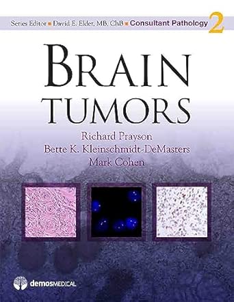 brain tumors 1st edition richard prayson ,bette k kleinschmidt demasters ,mark cohen 1933864699,