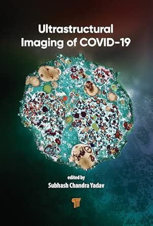 ultrastructural imaging of covid 19 1st edition subhash chandra yadav 9815352008, 978-9815352009