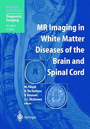 Mr Imaging In White Matter Diseases Of The Brain And Spinal Cord