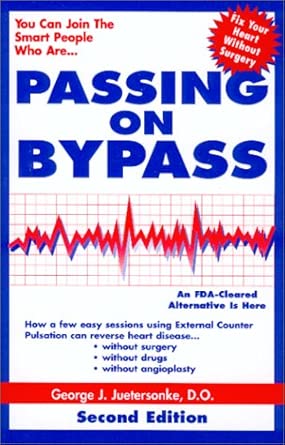 passing on bypass using external counterpulsation an fda cleared alternative to treat heart disea 1st edition