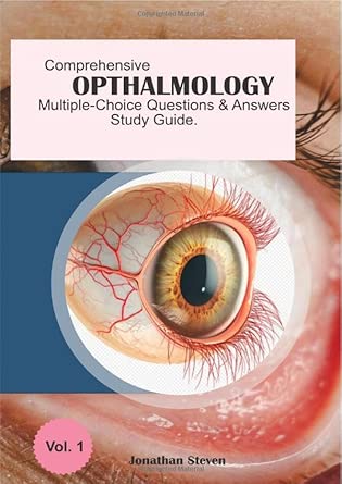 comprehensive ophthalmology multiple choice questions and answers study guide 1st edition jonathan steven
