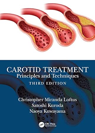 carotid treatment principles and techniques 1st edition christopher miranda loftus ,satoshi kuroda ,naoya