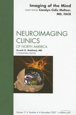 Imaging The Mind An Issue Of Neuroimaging Clinics V 17 4