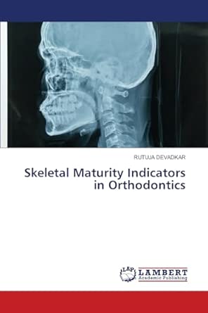 Skeletal Maturity Indicators In Orthodontics