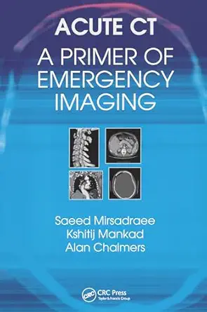 Acute Ct A Primer Of Emergency Imaging