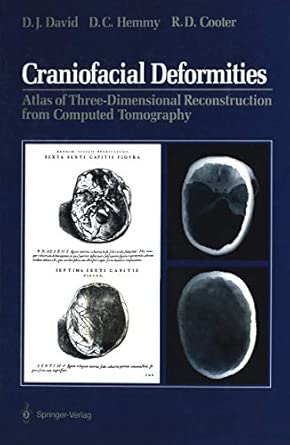 craniofacial deformities atlas of three dimensional reconstruction from computed tomography 1st edition david