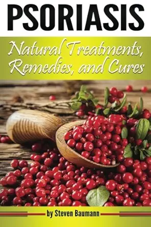 Psoriasis Natural Treatments Remedies And Cures Your Guide To Psoriasis Home Treatment Options
