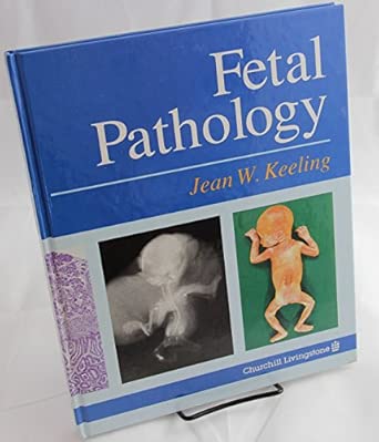 fetal pathology 1st edition jean w keeling 0443044260, 978-0443044267