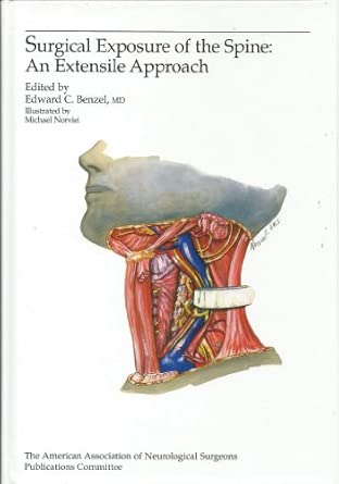 Surgical Exposure Of The Spine An Extensile Approach