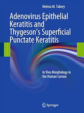 Adenovirus Epithelial Keratitis And Thygesons Superficial Punctate Keratitis In Vivo Morphology In The Human Cornea