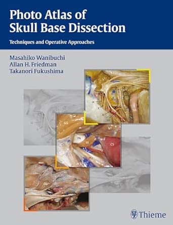 Photo Atlas Of Skull Base Dissection Techniques And Operative Approaches