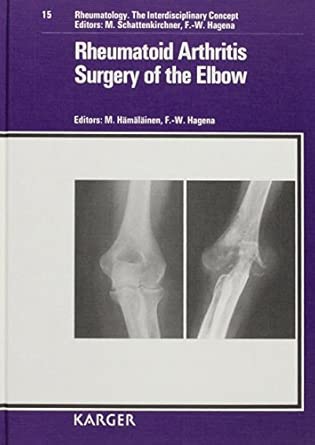 Rheumatology The Interdisciplinary Concept Rheumatoid Arthritis Surgery Of The Elbow 15