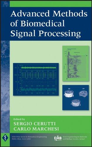 advanced methods of biomedical signal processing 1st edition sergio cerutti, carlo marchesi 0470422149,