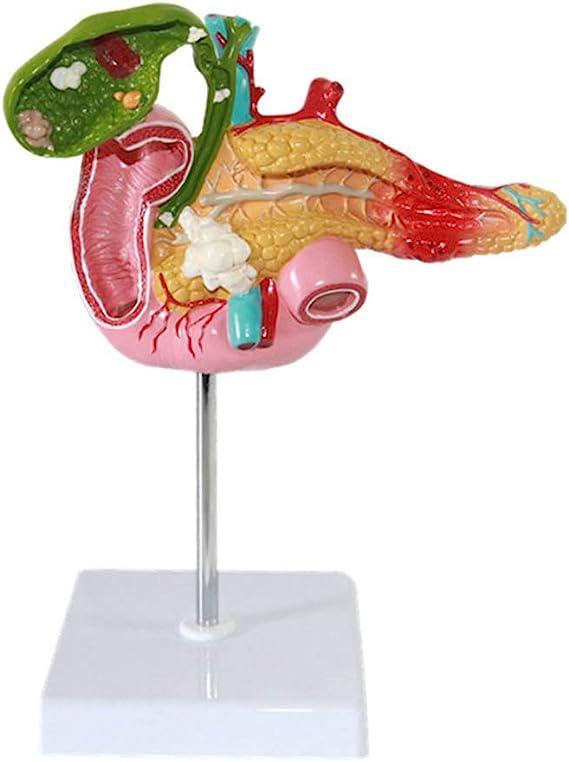 heybec pancreatic duodenal gallbladder pathology green human anatomy model  heybec b0c7l4d154