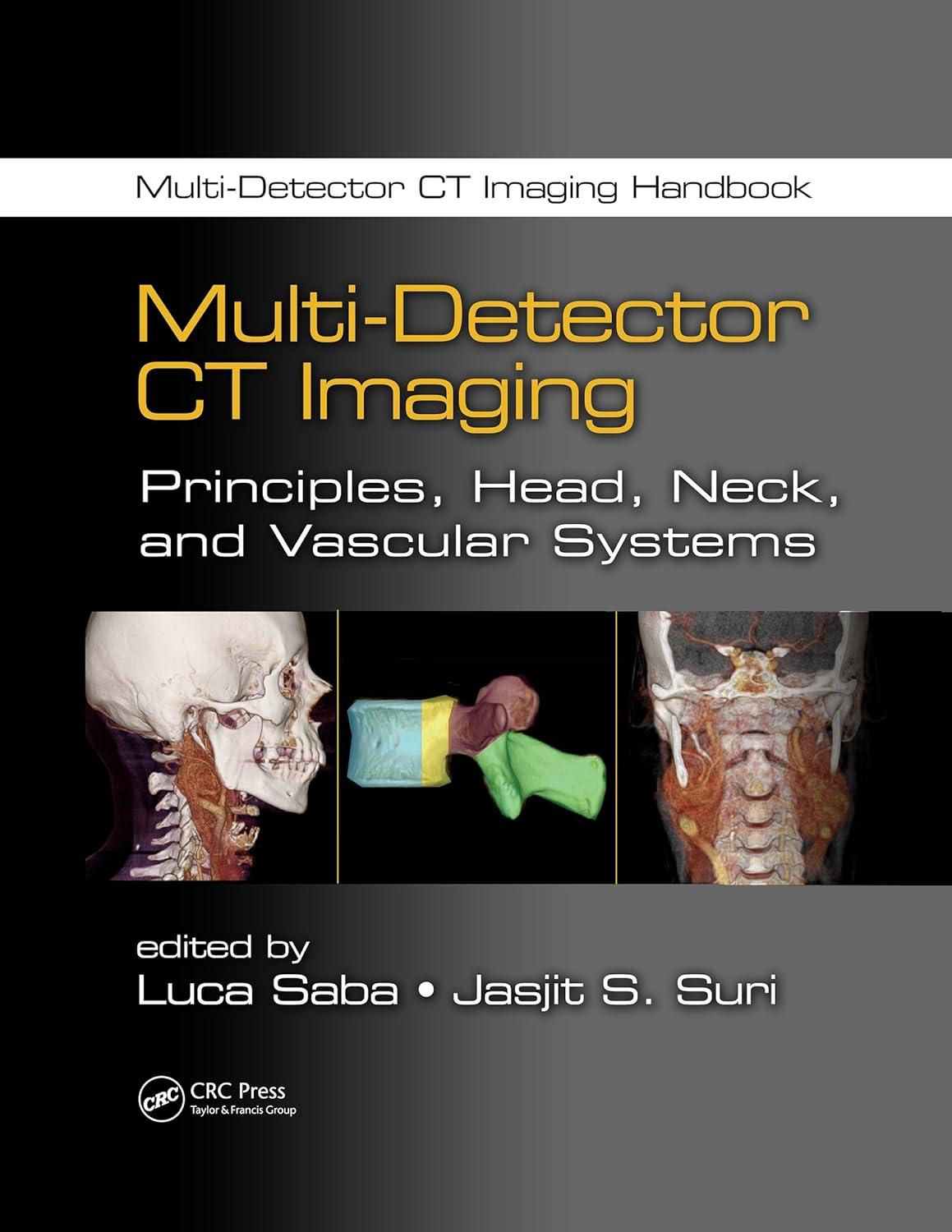 multi detector ct imaging principles head neck and vascular systems 1st edition luca saba, jasjit s. suri