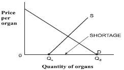 Draw a supply and demand curve for the U.S. organ