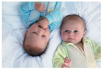 Twin Births. As a result of a greater number of