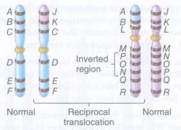 A chromosome involved in a reciprocal translocation also has an