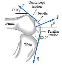 The figure shows the quadriceps and the patellar tendons attached