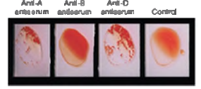 Commercially available antiserum samples containing antibodies for antigens A, B,