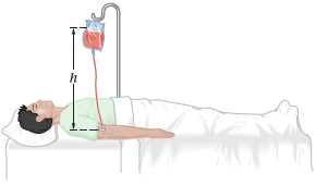 The patient in FIGURE 15-41 is to receive an intravenous