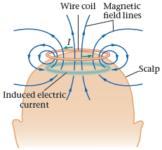 Magnetic field lines Wire coil Scalp Induced electric/ current 