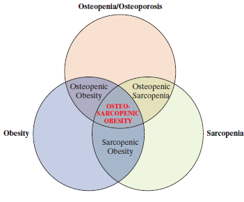 Osteopenia/Osteoporosis Osteopenic Obesity Osteopenic Sarcopenia OSTEO- SARCOPENIC OBESITY Obesity Sarcopenia Sarcopenic