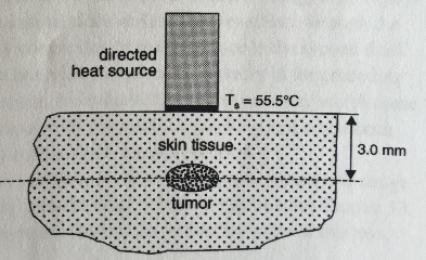 directed heat source T = 55.5°C %3D skin tissue 3.0 mm tumor- 