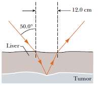 A narrow beam of ultrasonic waves reflects off the liver