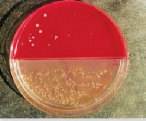 1. From chapter 3, figure. If this MacConkey agar plate