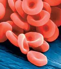 Fig. 1.18 is a picture of red blood cells seen