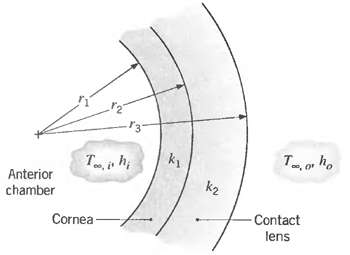 k1 Anterior chamber k2 Contact Cornea- lens 
