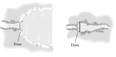 Dam Dam 