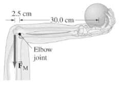 2.5 cm 30.0 cm- Elbow joint FM 
