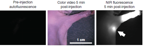 Color video 5 min post-injection NIR fluorescence 5 min post-injection Pre-injection autofluorescence 1 cm 