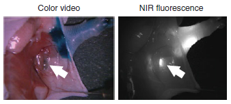 Color video NIR fluorescence 