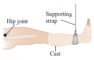 Supporting strap Hip joint Cast 